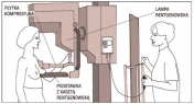 Schemat sprzętu do wykonywania mammografi